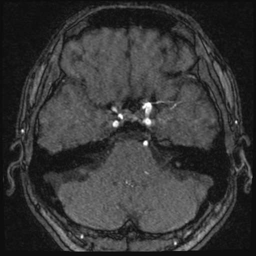 Click on the Serie image to view the images of VILLANUEVA, WILLIAM A.